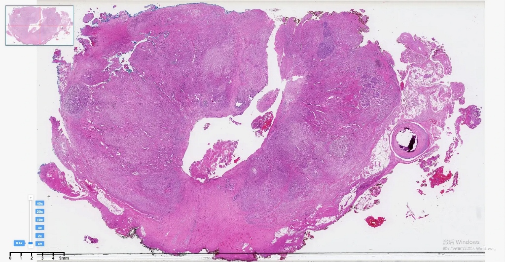ШІ допоможе українцям діагностувати рак. Що відомо про унікальні сканери